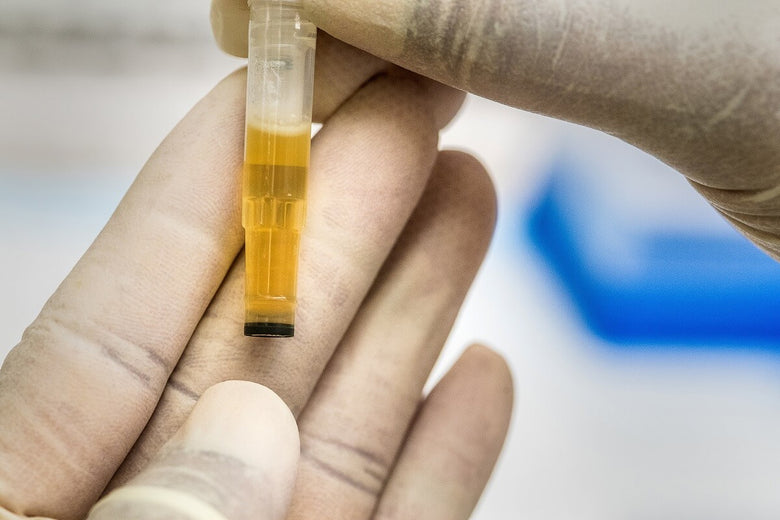 Right Times For Drug Testing in the Workplace