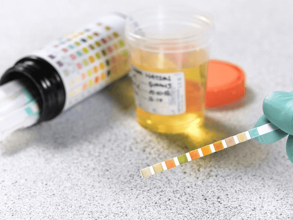 drug urine test